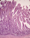 Vellosidades intestinales. Criptas de Lieberkhn. Pan.