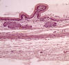 Vescula biliar. Mucosa, submucosa y muscular. Pan.