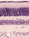 Retina sensitiva: Conos y bastones, bipolar y ganglionar. Capa pigmentaria.