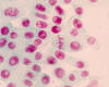 Cebolla. Mitosis: profase, metafase.