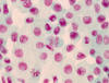 Cebolla. Mitosis: anafase, profase.