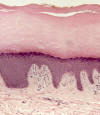 Plano estratificado con queratina. Piel gruesa. Dermis.