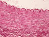 Fibras elsticas. Arteria muscular.