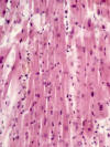 Msculo estriado cardiaco. Longitudinal.