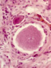 Neurona pseudomonopolar.