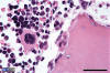 Distinguir entre osteoclasto (derecha) y megacariocitos (izq).