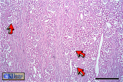 Corteza renal: Corpsculos de Malphighi o Glomrulos.