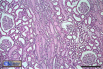 Corteza renal: Corpsculos de Malphighi o Glomrulos. Tbulos.