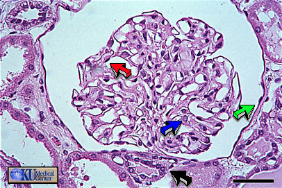 Glomrulo renal. Capilares. Capas visceral (podocitos) y parietal .