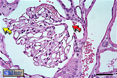 Roja polo vascular: arteriola aferente. Amarilla Polo urinario